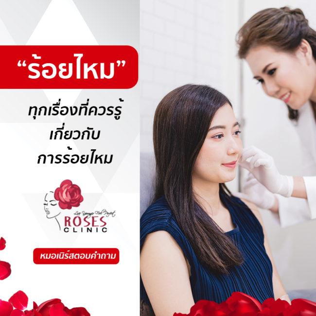 BLOG – ร้อยไหม ไหมละลาย roses clinic คลีนิกเสริมความงาม BLOG - ร้อยไหม ไหมละลาย roses clinic คลีนิกเสริมความงาม